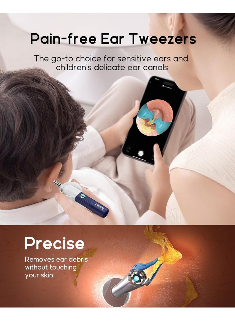 بيبيرد أداة إزالة شمع الأذن Earsight Plus I35R المزودة بكاميرا | منظف أذن ذكي مزود بملقط لطيف و12 طرفًا، منظار أذن عالي الدقة للبالغين والأطفال - Image 3